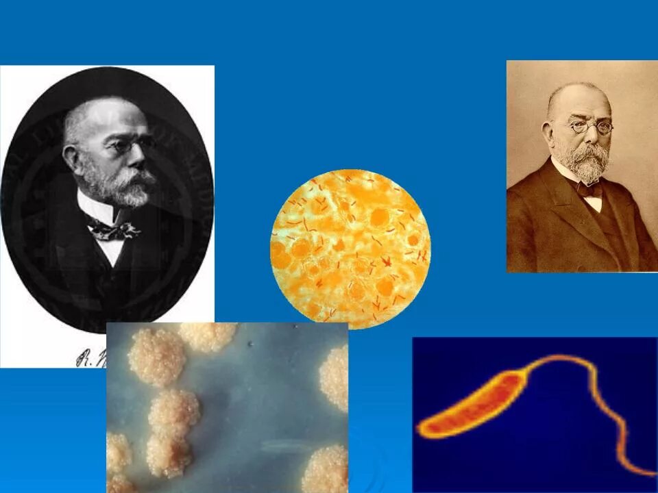 Палочка коха (mycobacterium tuberculosis). Кох р открытие туберкулезной палочки наука. Микобактерия туберкулеза палочка коха. Кох р открытие туберкулезной палочки наука. Кох р открытие туберкулезной палочки наука.
