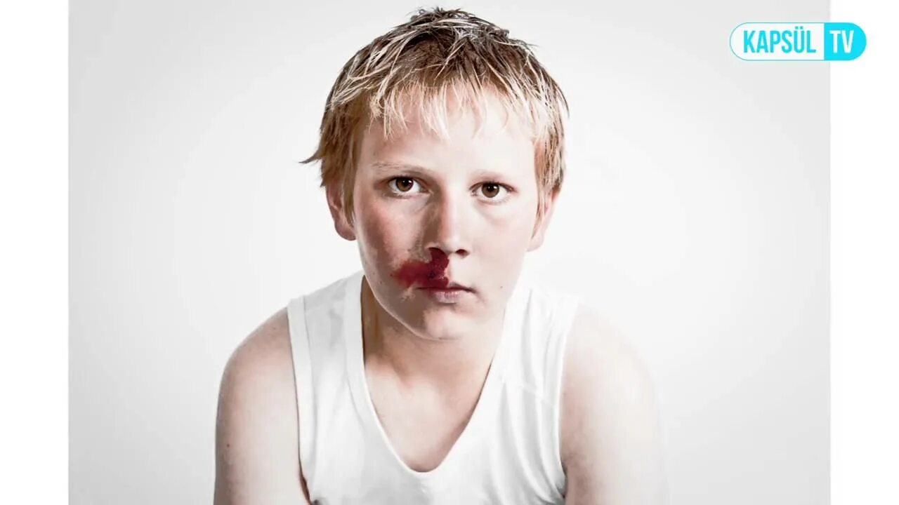 Matt mcclure nosebleed. Matt mcclure nosebleed