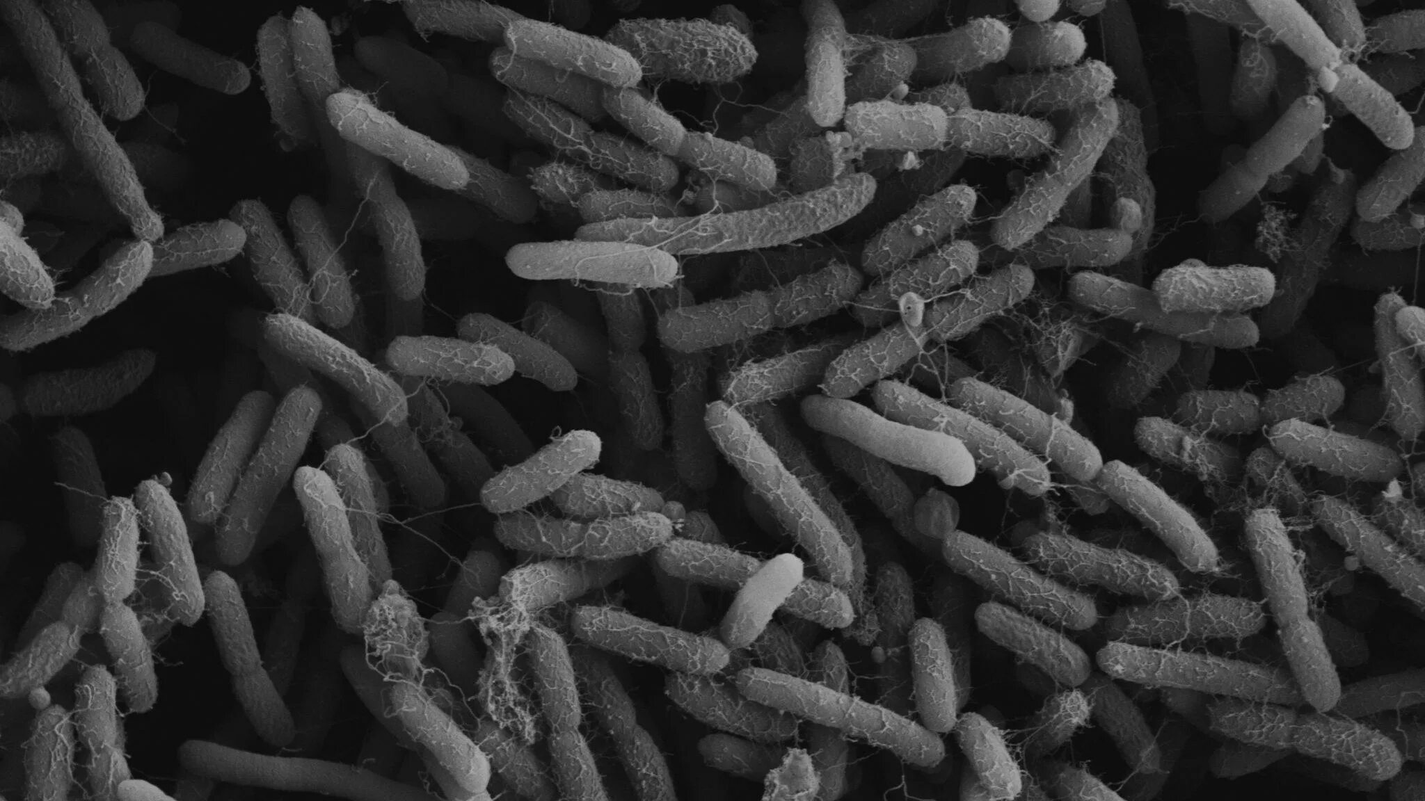 Бактерия Pseudomonas aeruginosa. Бактерия синегнойная палочка. Синегнойная палочка под микроскопом. Палочковидные бактерии псевдомонады.