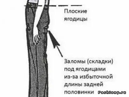 Складка под ягодицей
