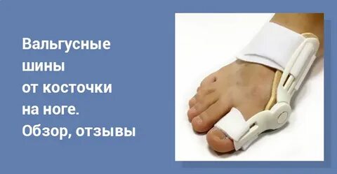 Косточка на ноге отзывы