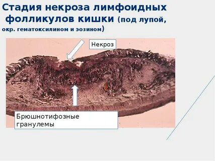 Стадия отторжения
