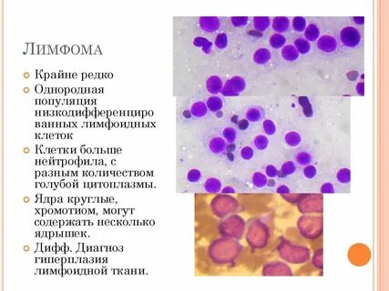 Периферическая т
