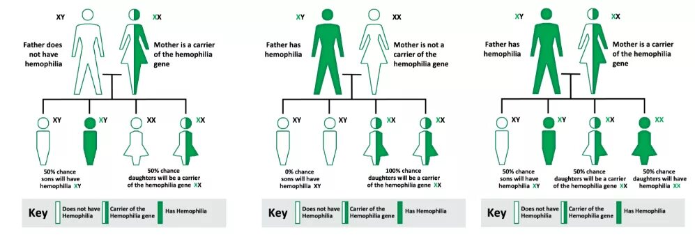 Тип наследования симптомы гемофилия. Гемофилия Тип наследования признака. Тип наследования при гемофилии. Гемофилия у новорожденных. Носители гемофилии женщины