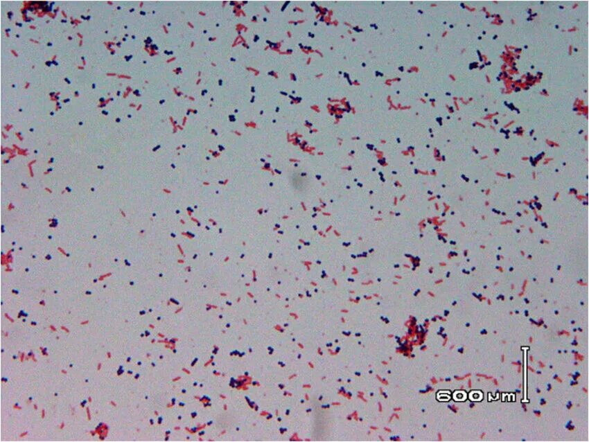 Corynebacterium spp в мазке у мужчин