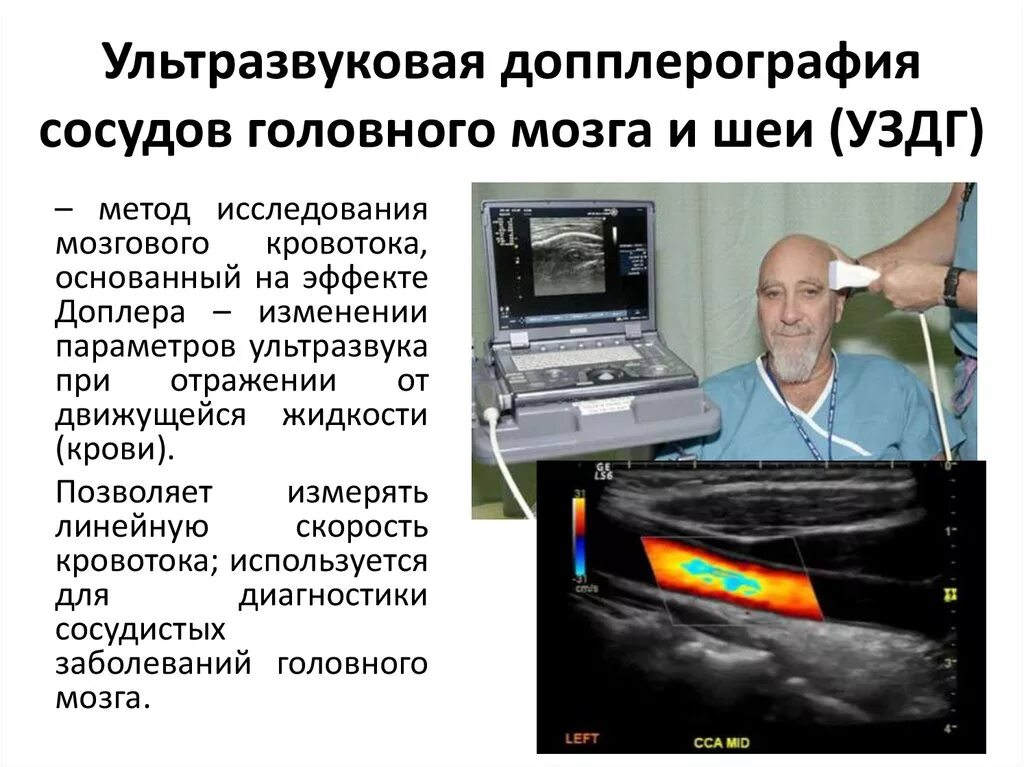 Ультразвуковая допплерография магистральных сосудов. Ультразвуковая допплерография сосудов головного мозга. Транскраниальных артерий и вен