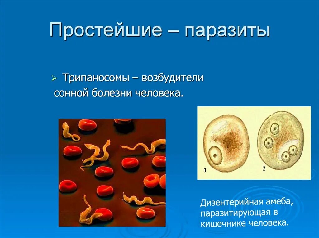 Инфекции вызванные простейшими. Простейшие паразиты амеба дизентерийная. Простейшие паразиты человека малярийный плазмодий. Болезни паразитических простейших. Простейшие заболевания у человека.