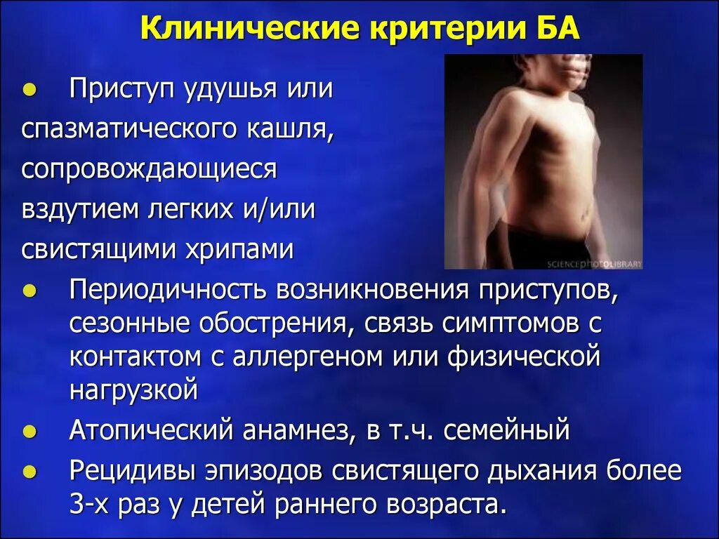 Заболевание сопровождающееся кашлем. Критерии приступа удушья. Клинические критерии ба. Приступ спазматического кашля. Приступ удушья кашель.