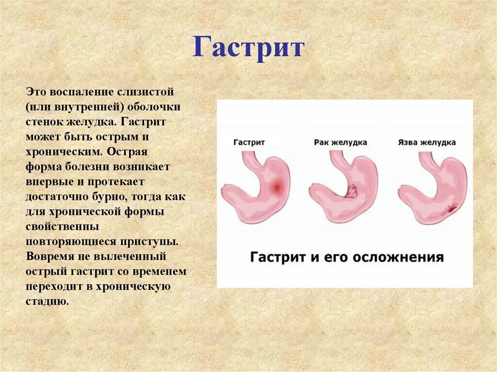 Заболевания жкт сообщение. Проект заболевания органов пищеварения 8 класс биология. Заболевание пищеварительной системы гастрит. Острый и хронический гастрит.