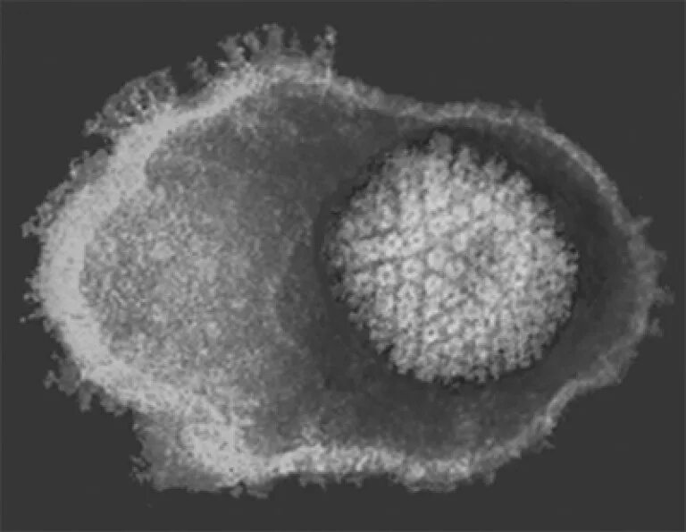 Antibiotics trigger herpes outbreak