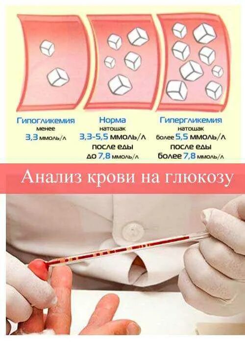 Анализ крови на глюкозу. Гипогликемия и гипергликемия показатели. Гипергликемия анализ крови. Подготовка к сдаче анализа на глюкозу.