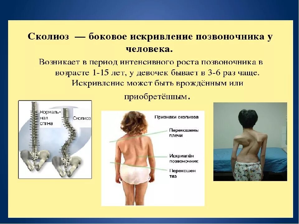 Позвоночник у ребенка это. Возрастные периоды формирования изгибов позвоночника. Позвоночник у грудного ребенка. Позвоночник у ребенка это. Позвоночник у ребенка это.