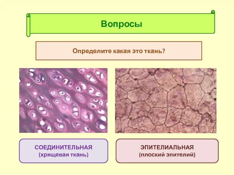 Какие функции выполняет эпителиальная ткань. Соединительная ткани хрящевая биология. эпителиальная и соединительная ткань. эпителиальная ткань и соединительная ткань. ткани эпителиальная соеди.