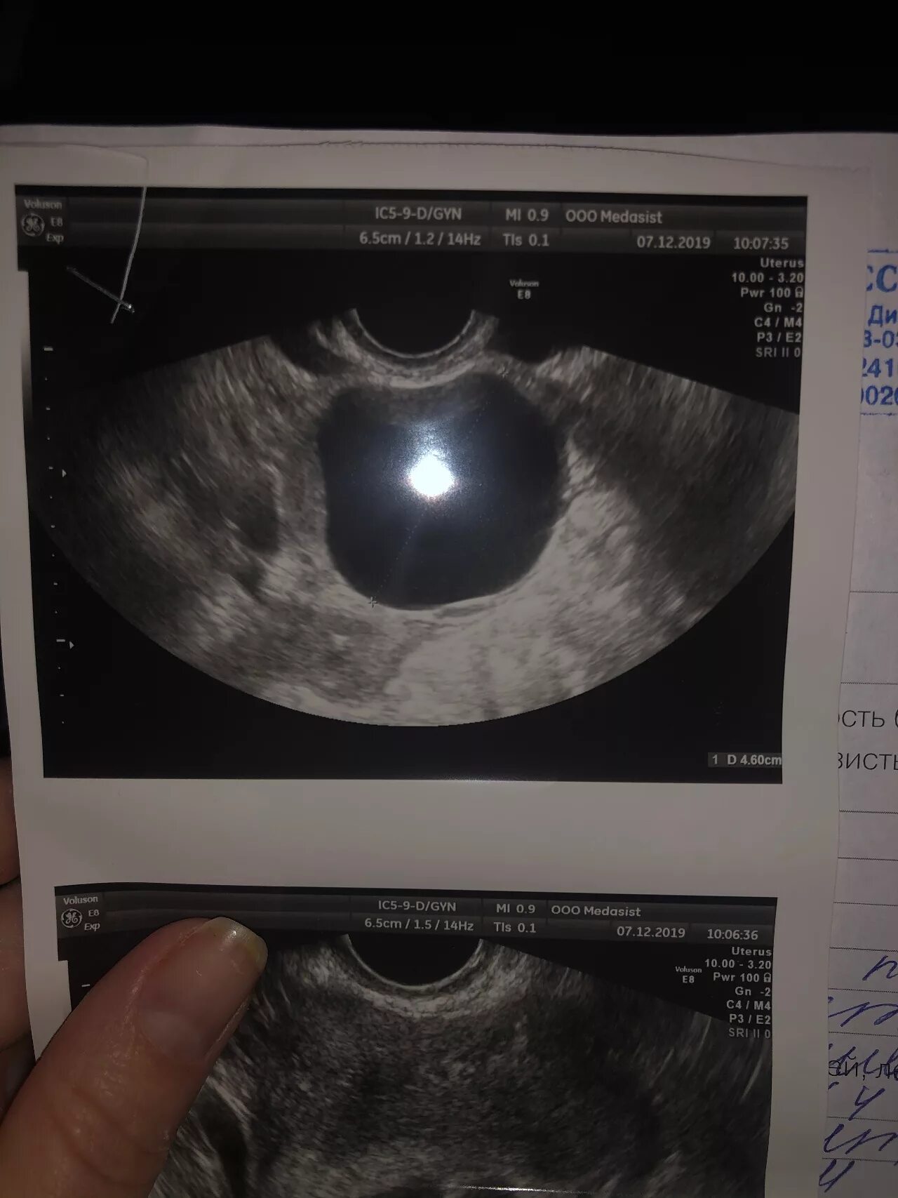 5 недель отзывы. Размер зародыша на 7 неделе. Размер эмбриона на 7 неделе.