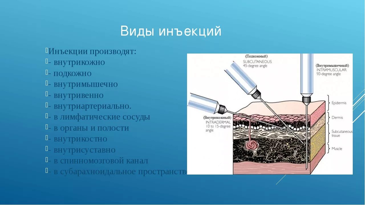 Внутрикожная инъекция угол введения иглы. Введение иглы при внутривенной инъекции. Внутрикожные подкожные и внутримышечные инъекции. Внутримышечная внутривенная подкожная внутрикожная инъекция.