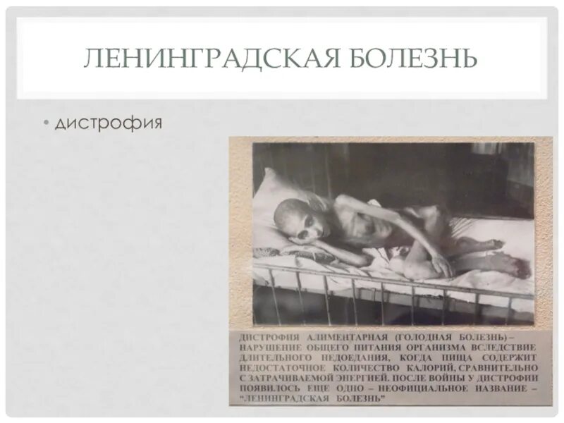 Дистрофия блокада ленинграда голод. Блокадный ленинград голод дети. Истории блокадного ленинграда для детей. Клинические проявления фенилкетонурии новорожденного. Микседема и базедова болезнь.