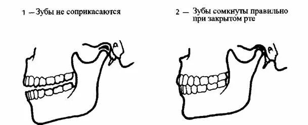 Зубы при закрытом рте. Правильное положение зубов. Правильное расположение челюсти. Нормальное положение зубов при закрытом рте. Положение челюсти при закрытом рте.