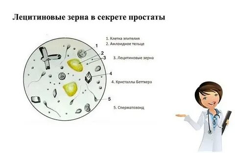 Моча после массажа простаты