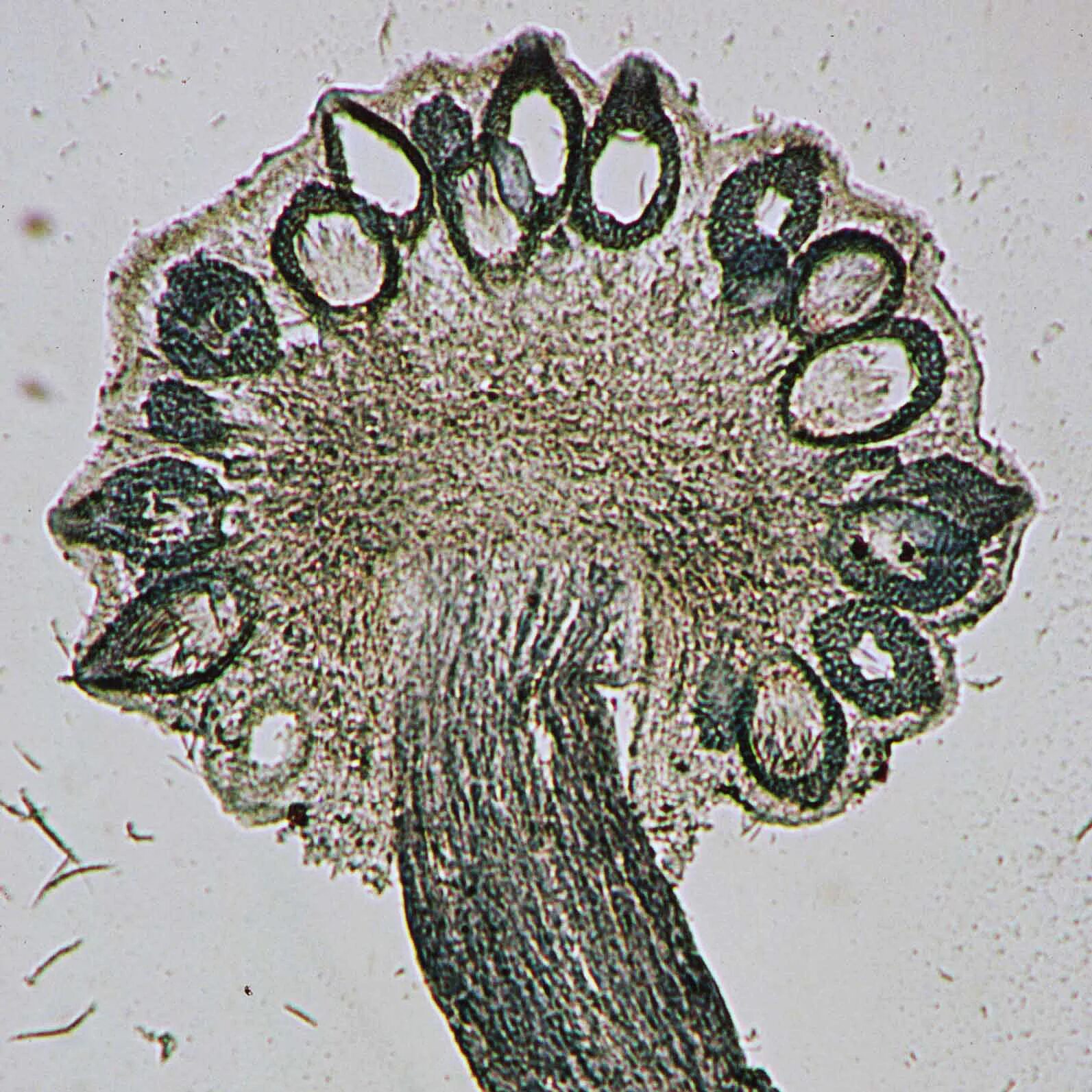 Claviceps purpurea под микроскопом. Спорынья (Claviceps purpurea). Спорынья (Claviceps purpurea Tulasne).. Эрготизм Claviceps. Грибы споры в организме