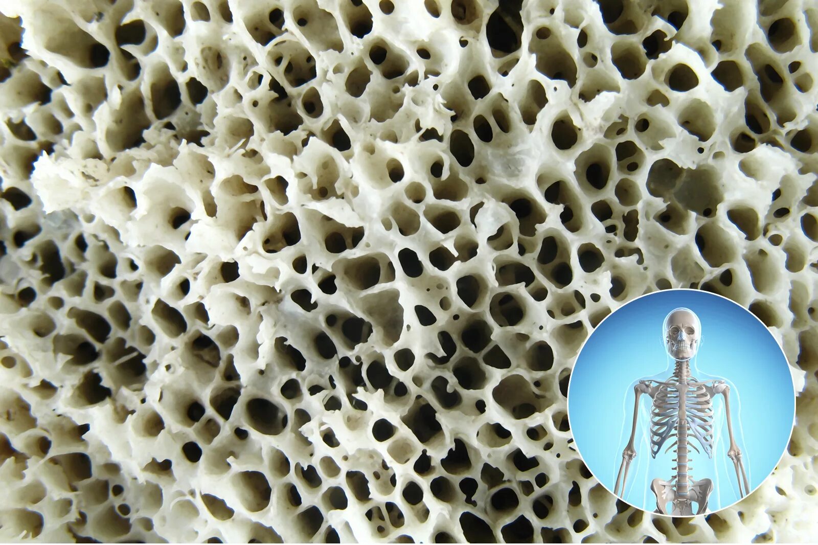 Хрящевая ткань костная ткань кровь. Костные клетки в костной ткани. Костная ткань в микроскопе. Костная ткань. Хрящевая и костная соединительная ткань рисунок.