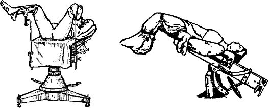 Положение больного на столе. Положение пациента на операционном столе. Основные позиции пациента на операционном столе. Положение пациента при операциях на органах брюшной полости. Положение больного на операционном столе по тренделенбургу..