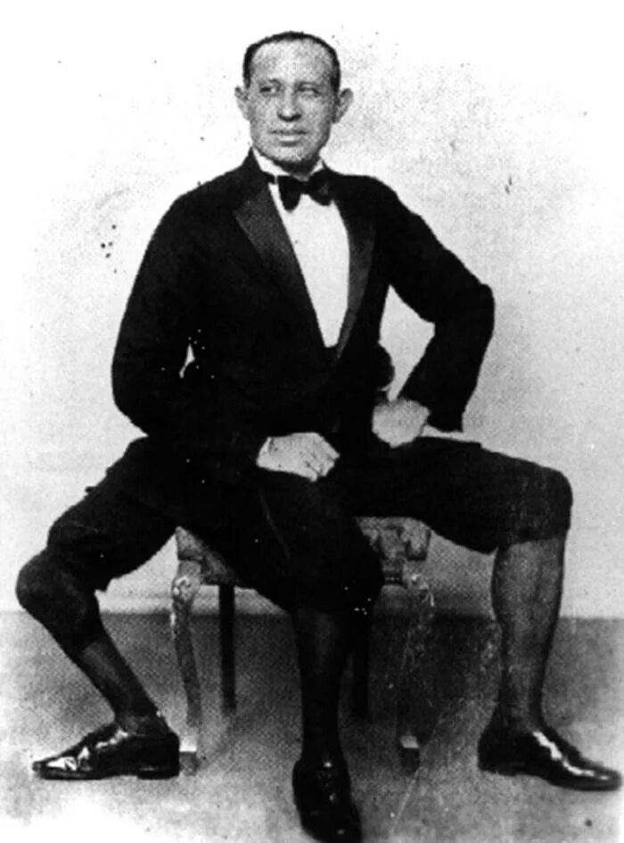 Видит три ноги. Франческо Лентини. Франческо (Фрэнк) Лентини. Американец Фрэнк Лентини. Франческо Лентини человек с тремя ногами.1889.