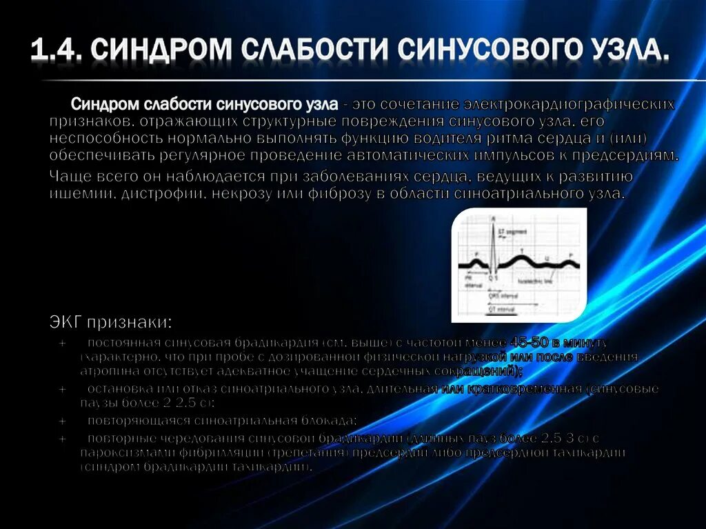 Дисфункция синусового узла что это. Синдром слабости синусового узла. Синдром слабости синусового узла классификация. Слабость синусового узла. Синдром слабости синусового узла лечение.