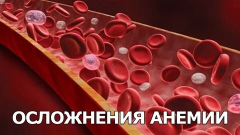 Анемия последствия