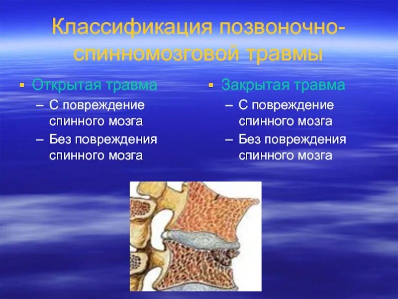 Позвоночно-спинномозговая травма. Классификация спинномозговой травмы. Позвоночно спинальная травма классификация.