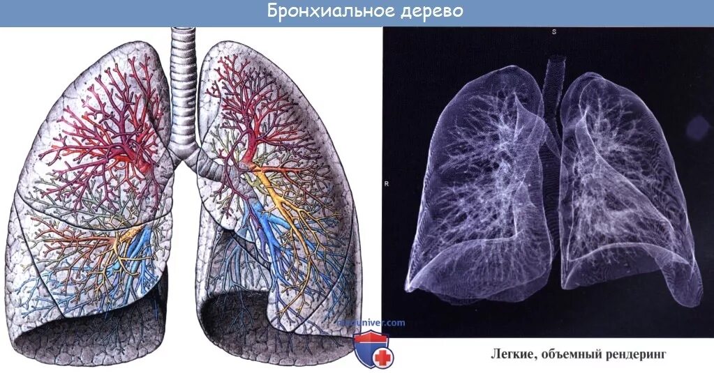 Бронхиальное дерево легких. Бронхиальное дерево и легкие. Бронхиальное дерево человека. Легкое бронхиальное дерево.