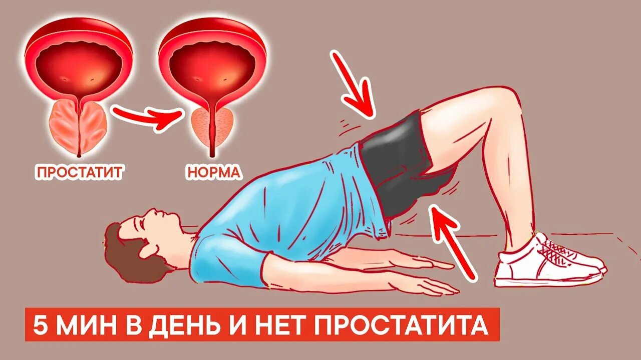 Гимнастика при простатите и аденоме. Упражнения от простатита. упражнения для простатита для мужчин. профилактика от простатита. упражнения при простатите для мужчин.