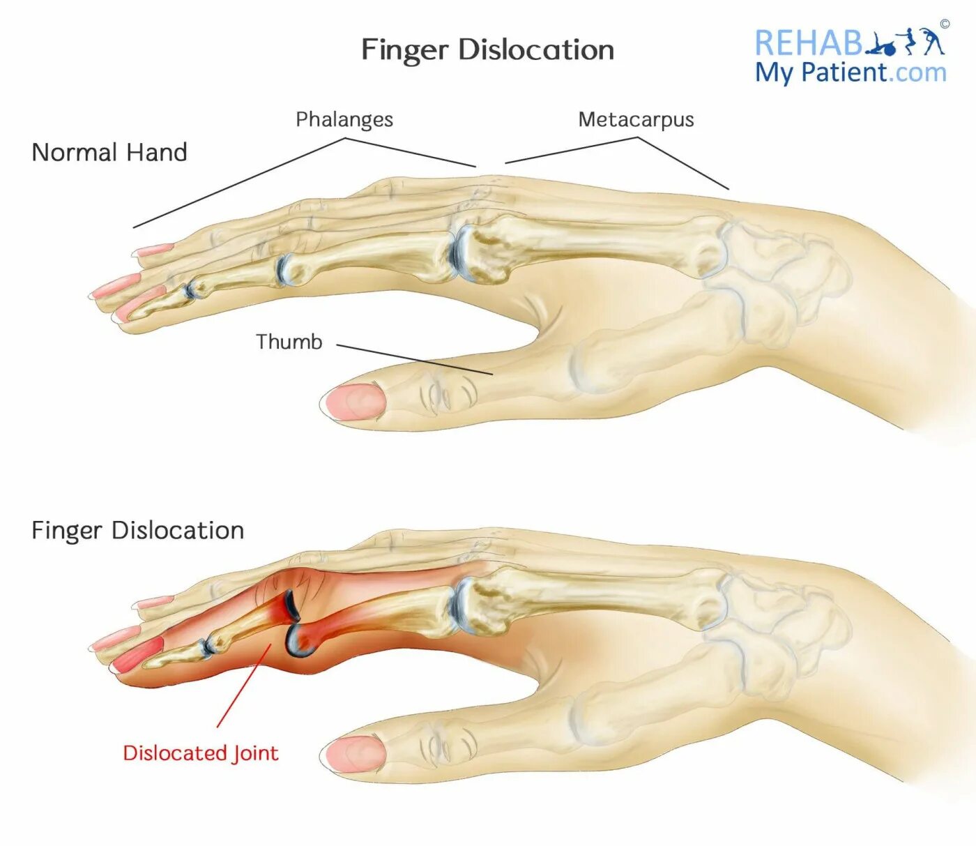 Анатомия кисти руки человека. Палец (анатомия). Части пальцев. Части пальца руки. The term applied