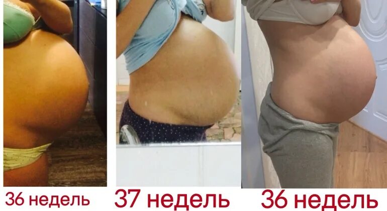 35 недель опустился живот. Опускание живота при беременности. Опустился живот на 35 неделе беременности.