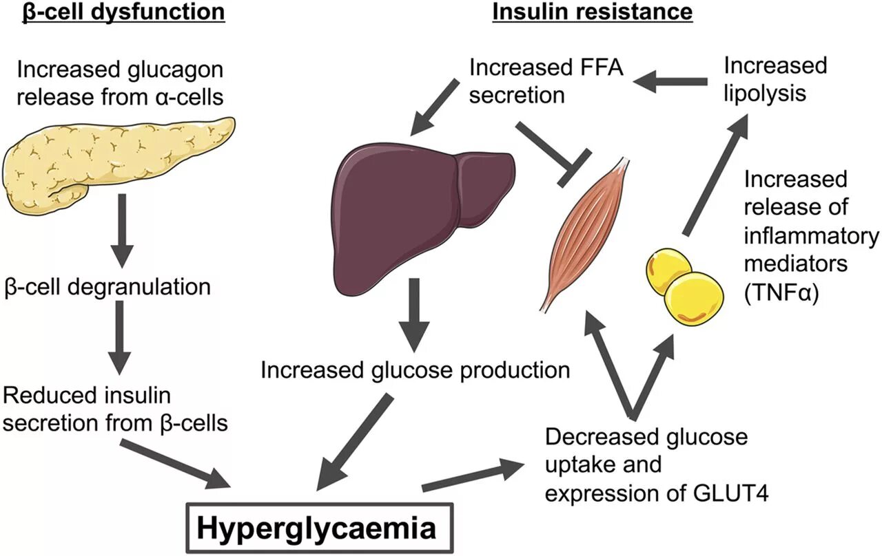 Insulin Resistance. Insulin Resistance Diabetes. Инсулин и глюкагон функции. Insulin Resistance картинки.