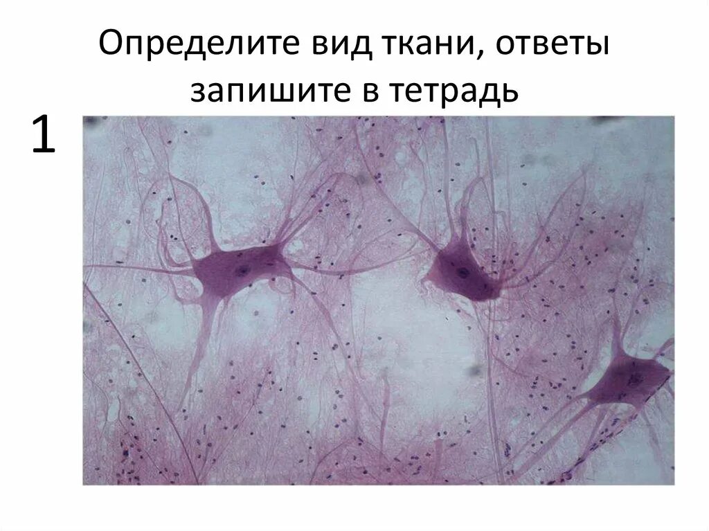 Гистология нервной системы нейроглия. Новообразования из нервной ткани. Опухоль нервной ткани на латинском. Опухоли нервов классификация. Опухоль нервной ткани на латинском.