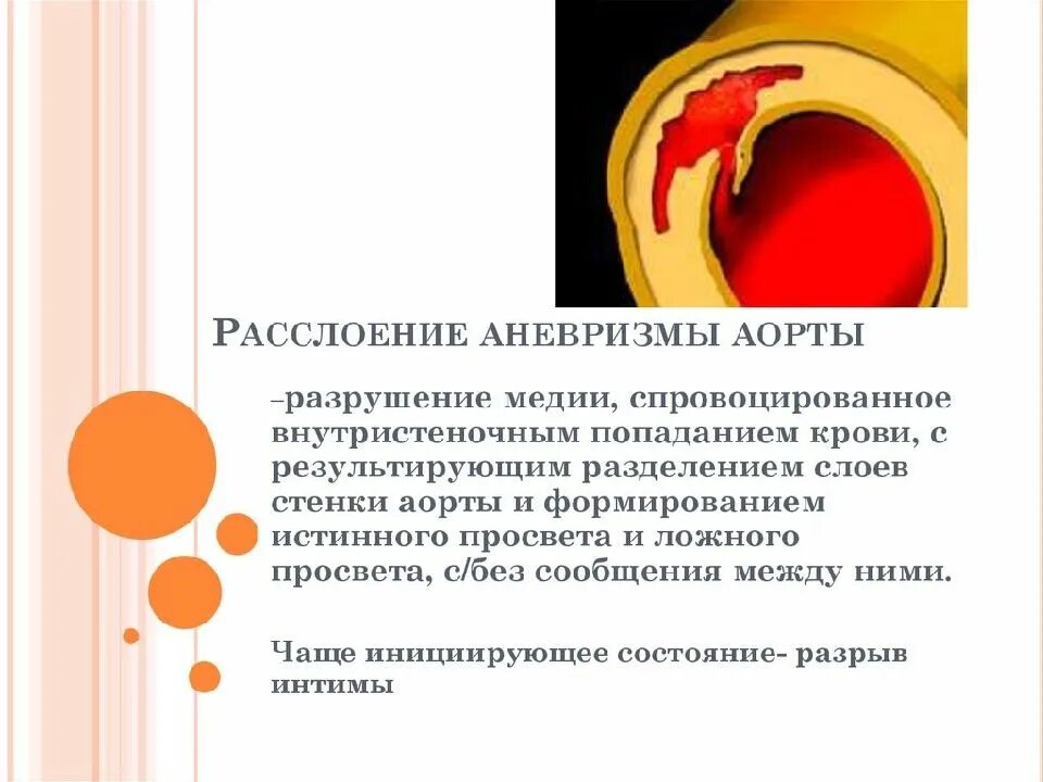 Атеросклеротическая аневризма аорты. Расслаивающая аневризма аорты патогенез. расслаивающая аневризма брюшного отдела. расслаивающая аневризма аорты симптомы. диагностика расслаивающейся аневризмы аорты.