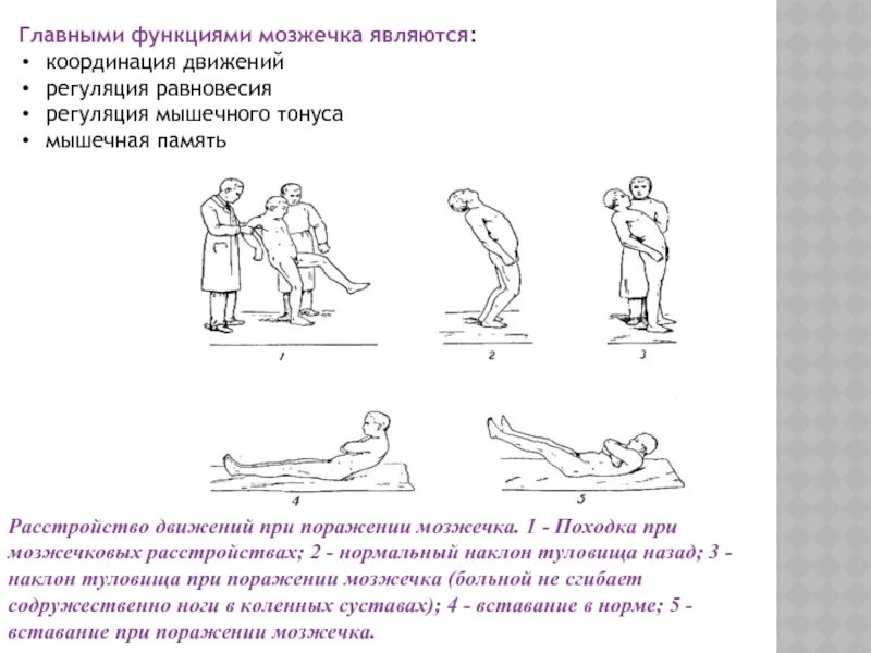 При поражении мозжечка. Походка при поражении мозжечка. Координация движений мозжечок. Нарушения функции мозжечка упражнения. Тест мозжечок