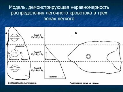 Три зоны