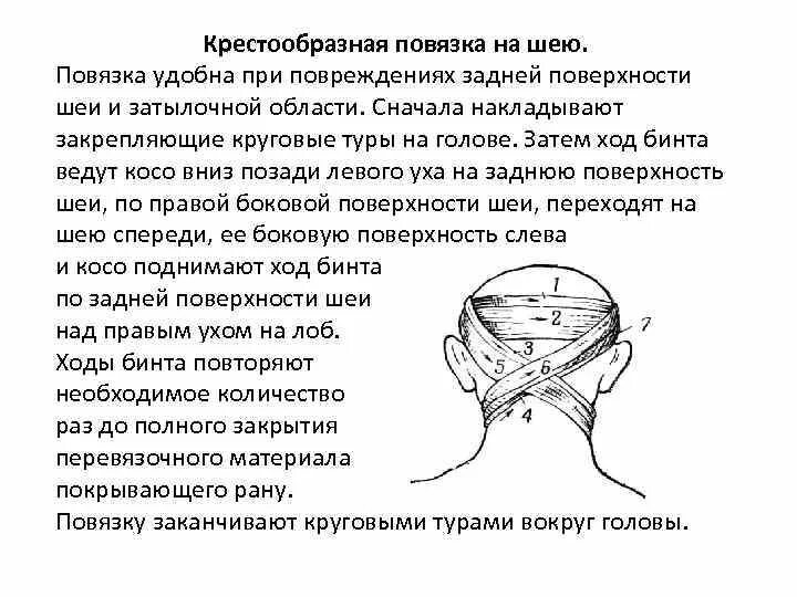 Технику наложения восьмиобразной повязки на затылок. Техники наложения крестообразной повязки на затылок. Алгоритм наложения крестообразной повязки на голову. Наложение крестообразной повязки на затылок алгоритм.