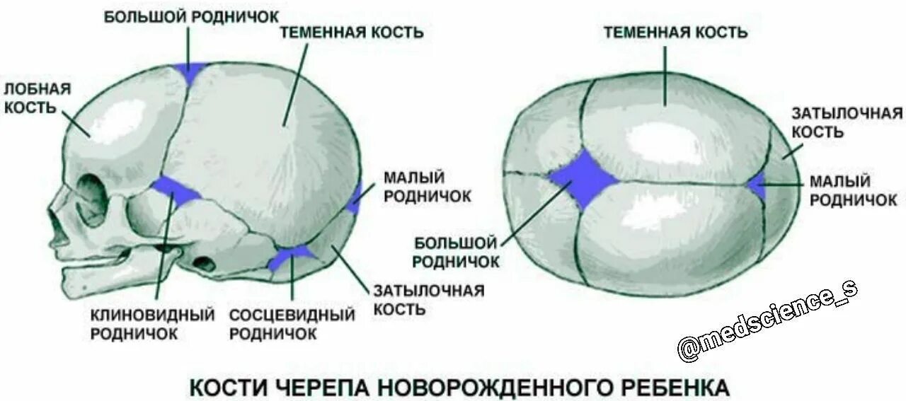 Родничок должен. Роднички черепа анатомия. Череп новорожденного ребенка с родничками и швами. Роднички новорожденного анатомия черепа. Череп новорожденного большой и малый Родничок.