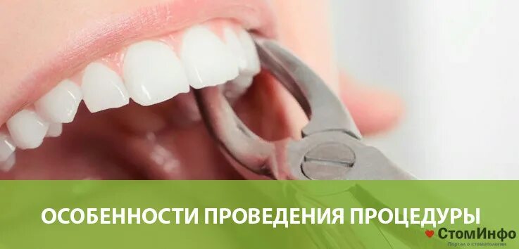 Выходные дни где можно удалить зуб. Выдернуть зуб в частной клинике. сколько стоит удалить зуб. стоматолог удалить зуб сколько стоит.