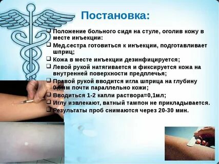 Постановка инъекций в бедро