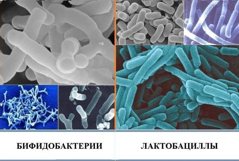 Полезные микроорганизмы. Бифидобактерии и энтерококки. Бифидо и лактобактерии под микроскопом. Пробиотики пребиотики лактобактерии бифидобактерии. Бифидобактерии бифидум микроорганизмы.