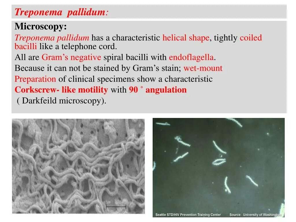 Treponema pallidum igм igg. Трепонема паллидум строение. Трепонема паллидум грамотрицательная. Бледная трепонема микробиология. Трепонема паллидум характеристика.