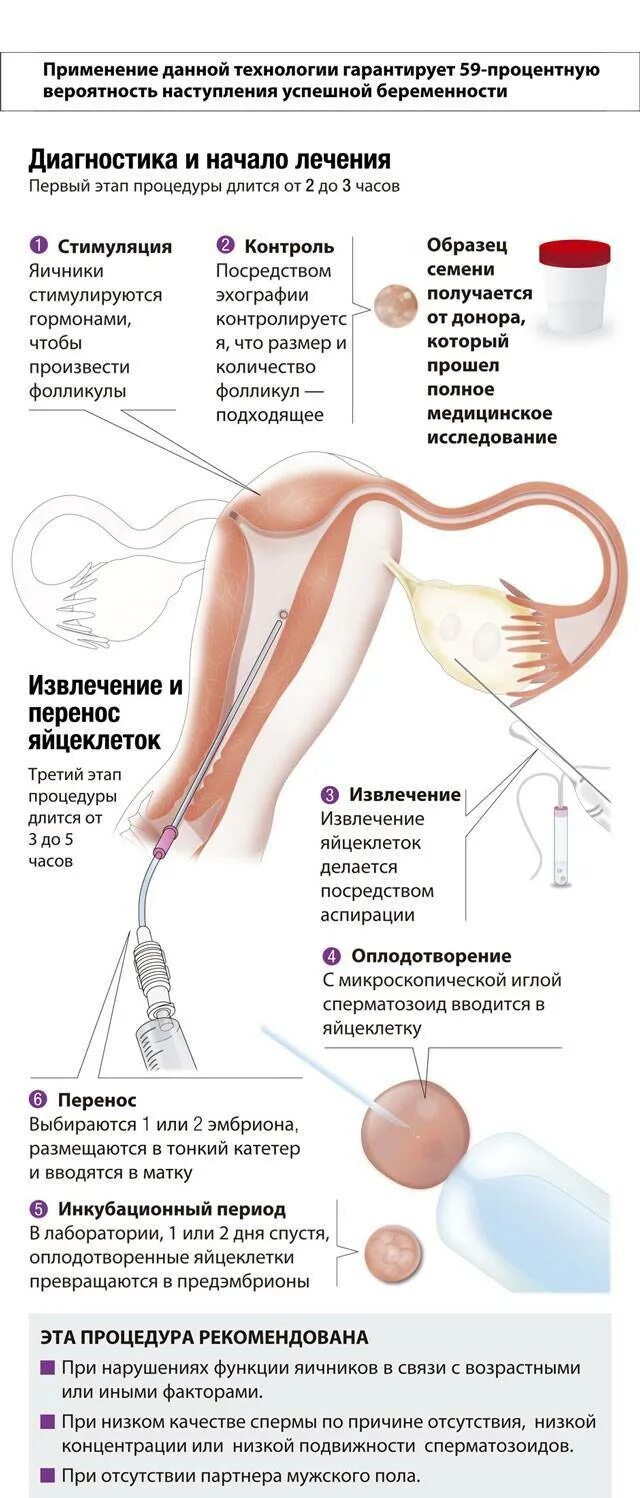 Эко от донора. Донорство яйцеклеток. Эко с донацией яйцеклетки. Донорская яйцеклетка. Эко с донорским эмбрионом.