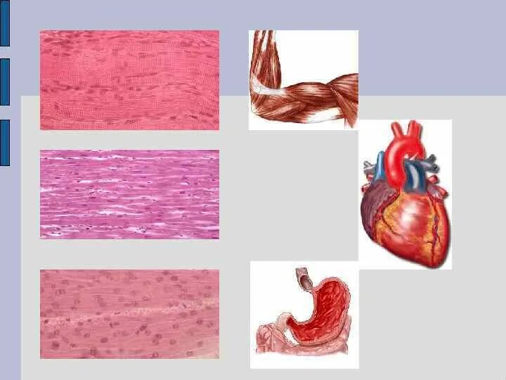 Как выглядит гладкая мышечная ткань. Мышечная ткань. Мышечная ткань ткань. Разновидности мышечной ткани. Органы из мышечной ткани.