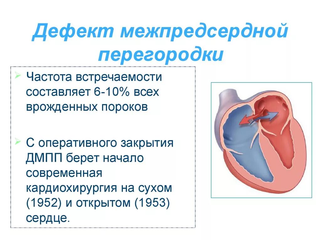 Окно в сердце у ребенка. Врожденный порок сердца дефект межпредсердной перегородки. Дефект предсердной перегородки у ребенка. ВПС дефект межпредсердной перегородки. Врожденный порок сердца ДМПП.