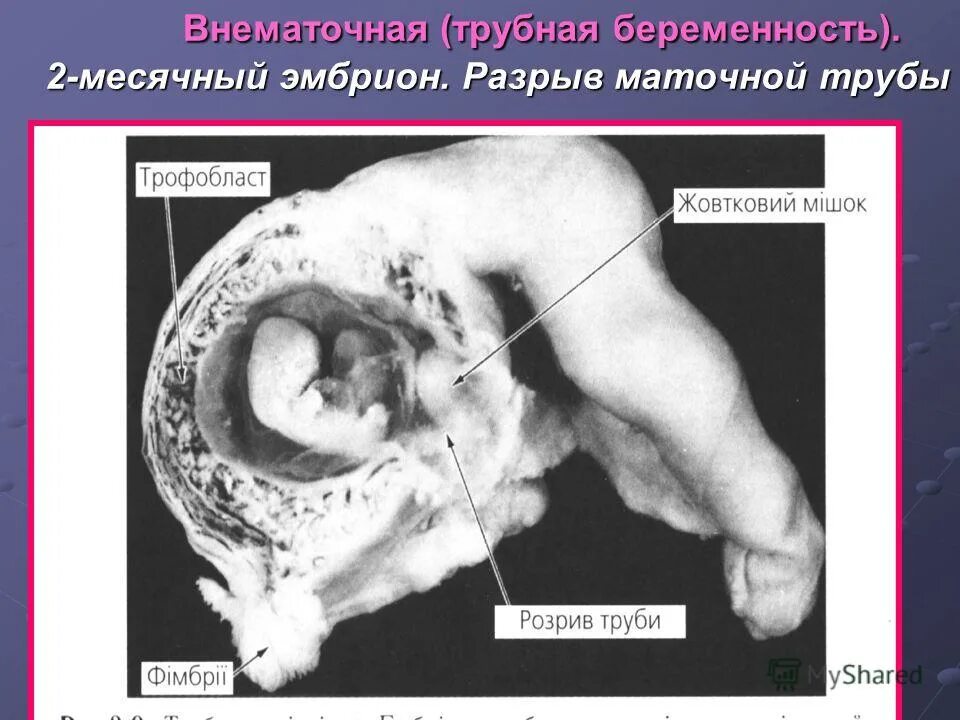 Мультфильм эмбрион который появился из холода. Эмбрион который появился из холода. Эмбрион который появился из холода. Принцесса эмбрион. Из яйцеклетки появляется эмбрион.