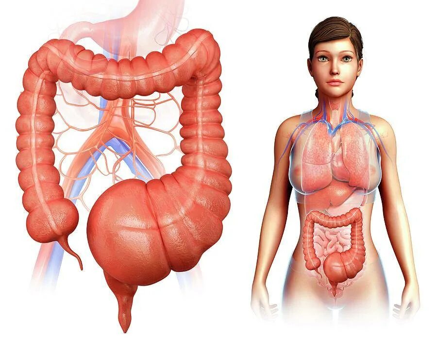 Долихосигма толстой кишки. Увеличение кишечника. Увеличение кишечника. Принцип действия слабительного средства. Дивертикулит и дивертикулез.