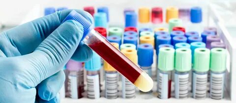 Streck Laboratories - американский производитель гематологических анализаторов